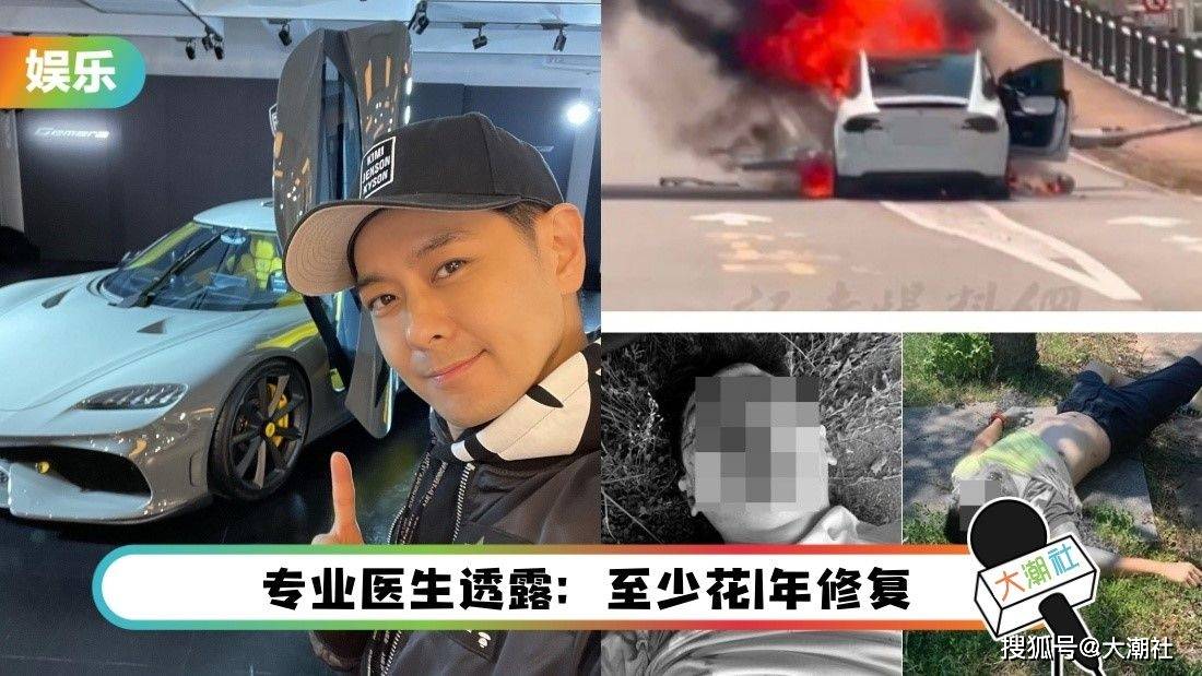 林志颖“颜面骨折”可能需整型！网优：不老神颜要陨落了吗