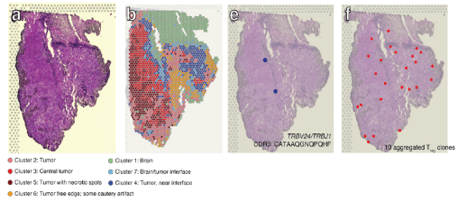 空间转录组之免疫组库分析