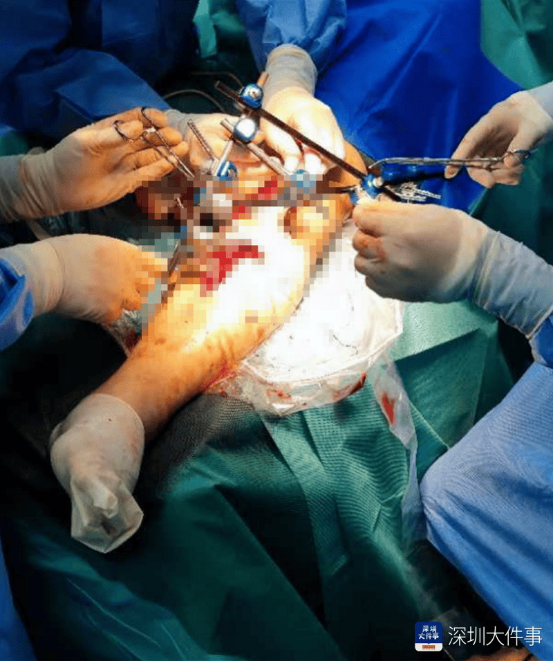 失血过半！深圳男子被三四百斤模具砸到<strong></p>
<p>淘金矿场app</strong>，医生全力抢救