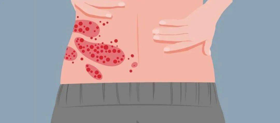 一旦感染终身携带<strong></p>
<p>aaa币行情</strong>!深圳疾控提醒:这4类人要注意