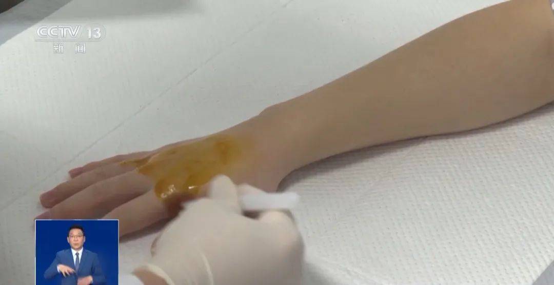 南方游客在哈尔滨“泼水成冰”受伤<strong></p>
<p>鲸鱼币</strong>!最新提醒