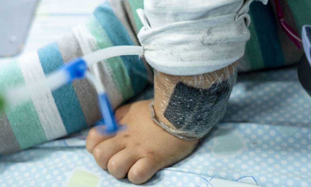 可瞬间产生近100℃高温<strong></p>
<p>重庆炒币群</strong>!合肥医生发出提醒