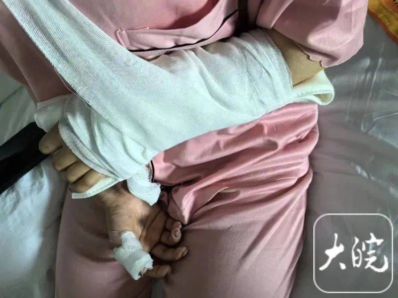 洗澡时突然爆炸<strong></p>
<p>弱打币</strong>,女子手筋断裂,多处缝针……家里有它快自查