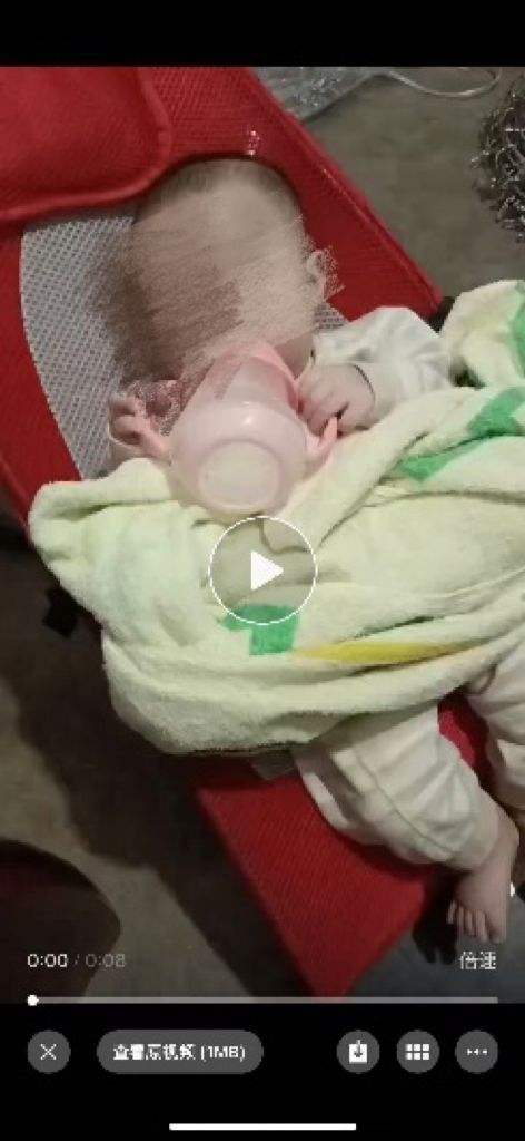 8个月女婴被饿成皮包骨住进重症监护室<strong></p>
<p>c币交易</strong>，当地回应：未发现虐待