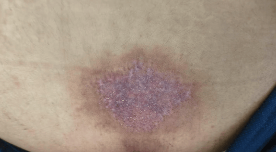 14岁女孩在拓展营遭体罚去世<strong></p>
<p>炒币视频教程</strong>，班主任因截留其给父母信件受审