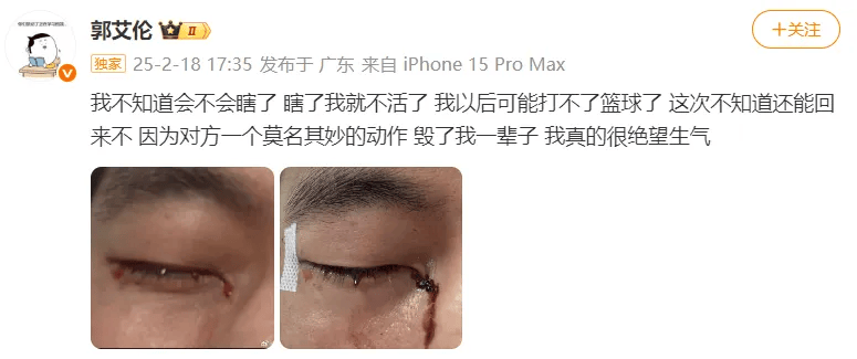 31岁郭艾伦直言想回国家队<strong></p>
<p>沃尔核材股票</strong>,但应该没什么机会了,此前眼睛被队友误伤,缝了40多针