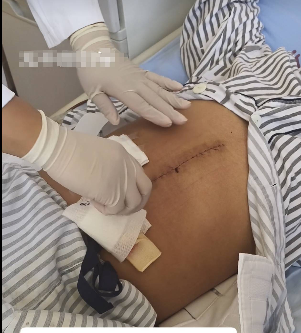 奶奶在哭<strong></p>
<p>居然之家股票</strong>，宝宝在笑！40天女婴重病，00后父亲割肝救女，术后这一幕让网友泪奔