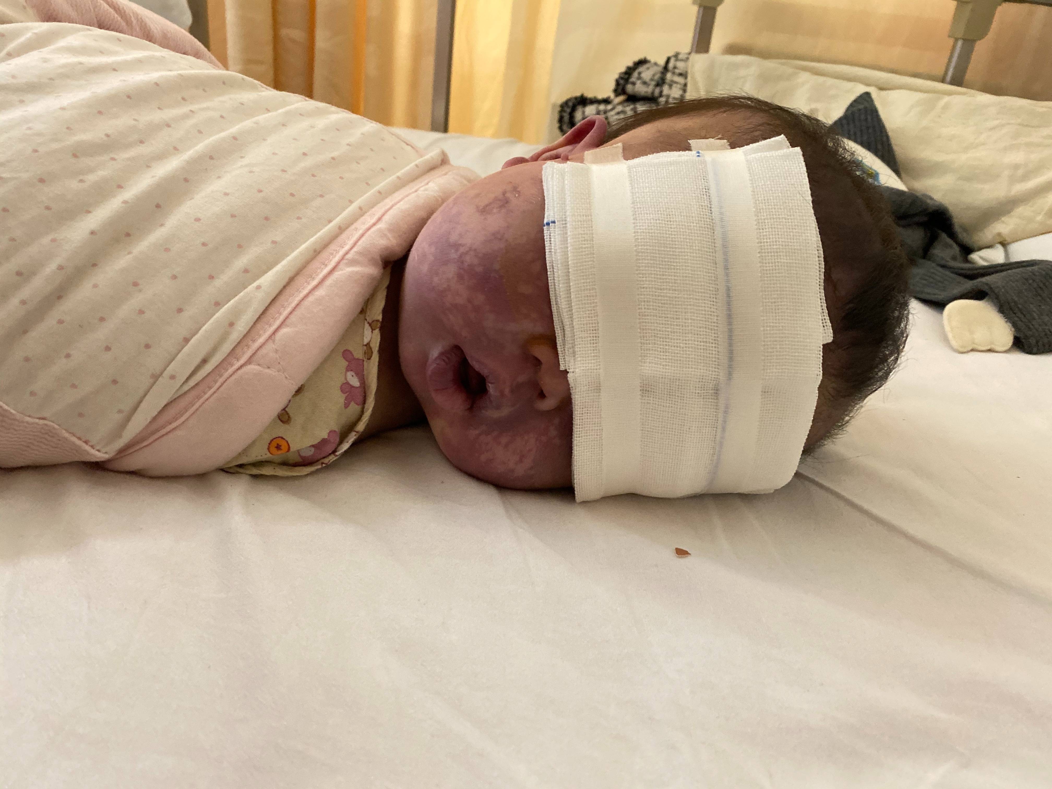 上饶6岁女童患病满身红斑<strong></p>
<p>江苏有线股票</strong>，初上幼儿园妈妈字里行间满是担心：曾经绝望，现在能看到光