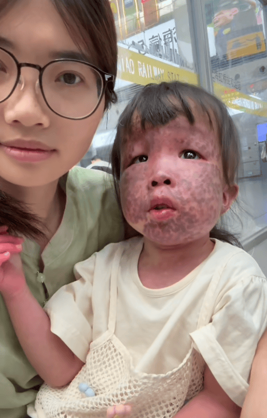 上饶6岁女童患病满身红斑<strong></p>
<p>江苏有线股票</strong>，初上幼儿园妈妈字里行间满是担心：曾经绝望，现在能看到光