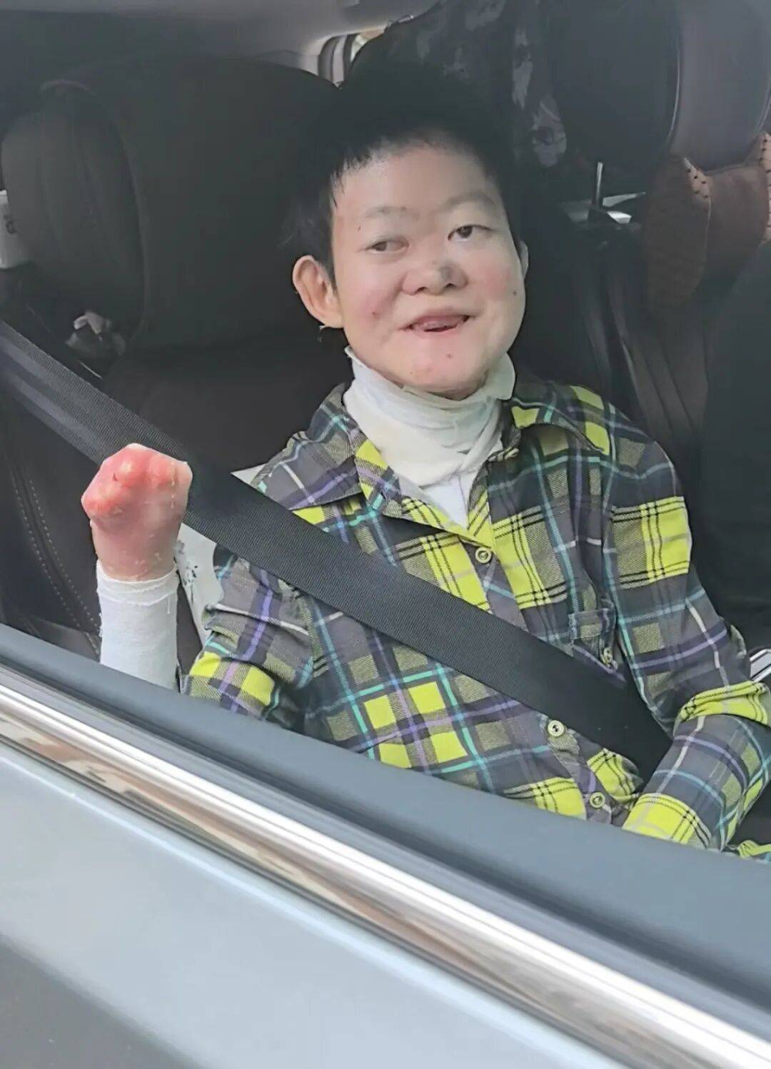 医生断言“活不过2岁”的郑州罕见病女孩，24岁“带伤出征”，开启西藏之行