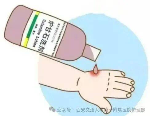 西安多区发现隐翅虫？千万别拍<strong></p>
<p>宝钢股份股票</strong>！毒液堪比硫酸