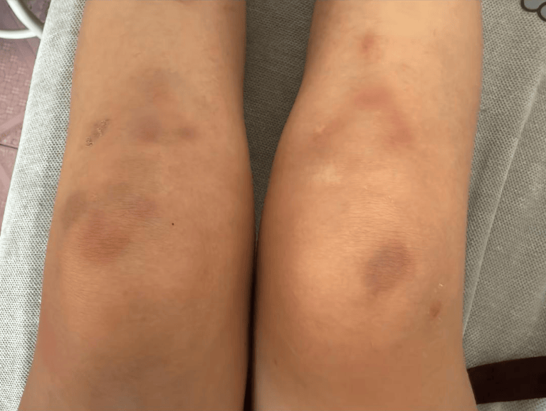 女子自称因工资问题被老板锁办公室里打 警方：双方已到派出所<strong></p>
<p>鱼跃医疗股票</strong>，是否打人还在调查