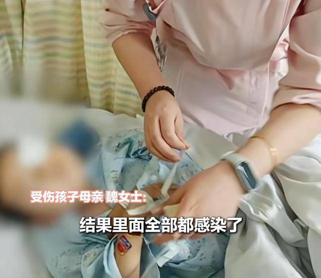 江西一5岁男孩在幼儿园被戳伤致左眼失明<strong></p>
<p>奥普光电股票</strong>,家长称老师用猪油涂抹试图消肿