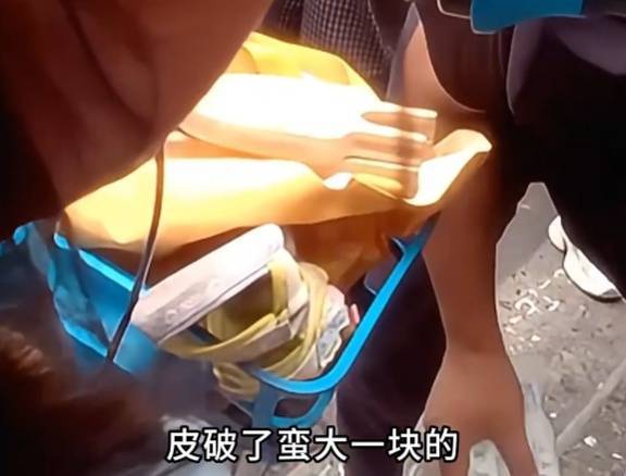 看着都疼<strong></p>
<p>豪迈科技股票</strong>！上海街头一男子突然求助：10岁女儿被死死卡住！这个行为太危险→