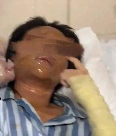 湖南一女主播被伪装的包裹炸伤<strong></p>
<p>豪迈科技股票</strong>，永州公安：正在核实具体情况