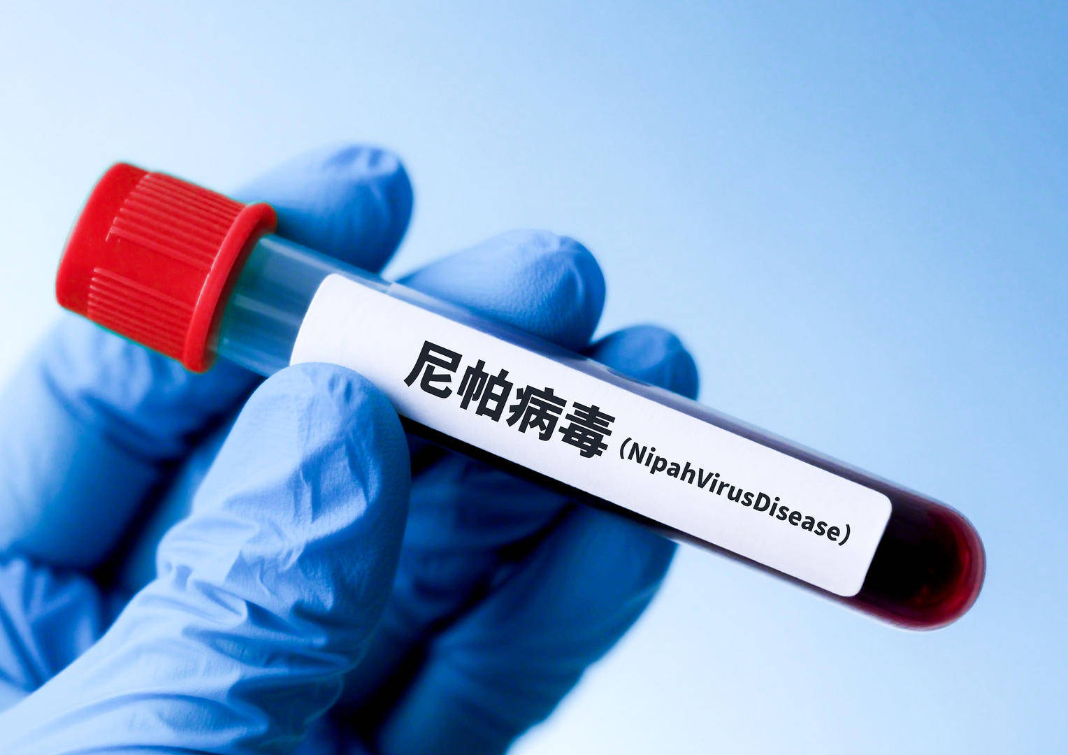 印度尼帕病毒拉响警报，尚无疫苗和有效疗法，检测试剂盒受关注，多家上市公司回应