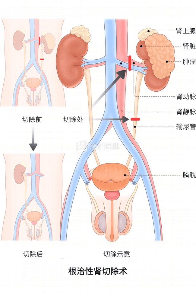“感觉天塌了”！深圳女孩5岁患癌<strong></p>
<p>星巴克股票</strong>，爸妈决定：为她冻存卵巢组织